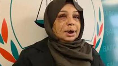 Eşine Şiddet İddiasıyla Tutuklandı, Suçu Reddetti: “Mağdur Olan Benim”